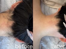サロンミニー(salon’Minnie)の雰囲気（自分では見えない部分もプロにお任せ♪全身脱毛/うなじ脱毛）