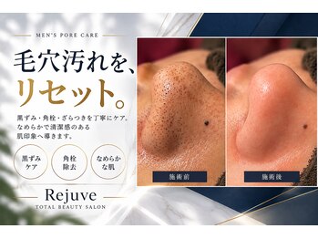 リジュベ(Rejuve)の写真/【毛穴】頑固な毛穴の黒ずみ・詰まり・小鼻のざらつきを劇的改善。毛穴ケアでつるんと清潔感のある素肌へ♪