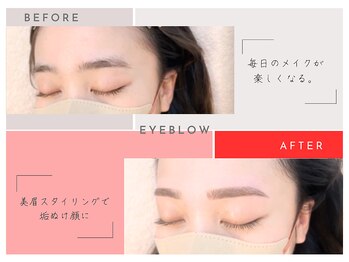 ミメル バイ ラフォンテ(mimelle by LAFONTE)/まゆ毛Wax脱毛before/after