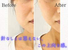 モアビューティーエステ 本通り店(MORE BEAUTY ESTHE)
