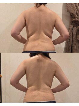 トータルエステティック ジョワイユ(JOYEUX)/お腹&背中ケア