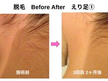 さりげなくキレイを感じるうなじへ。