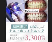 ホワイトニングバー 大宮店