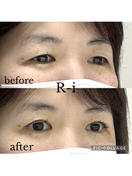 アールアイ(R-i)/アイリッドアップパーマ