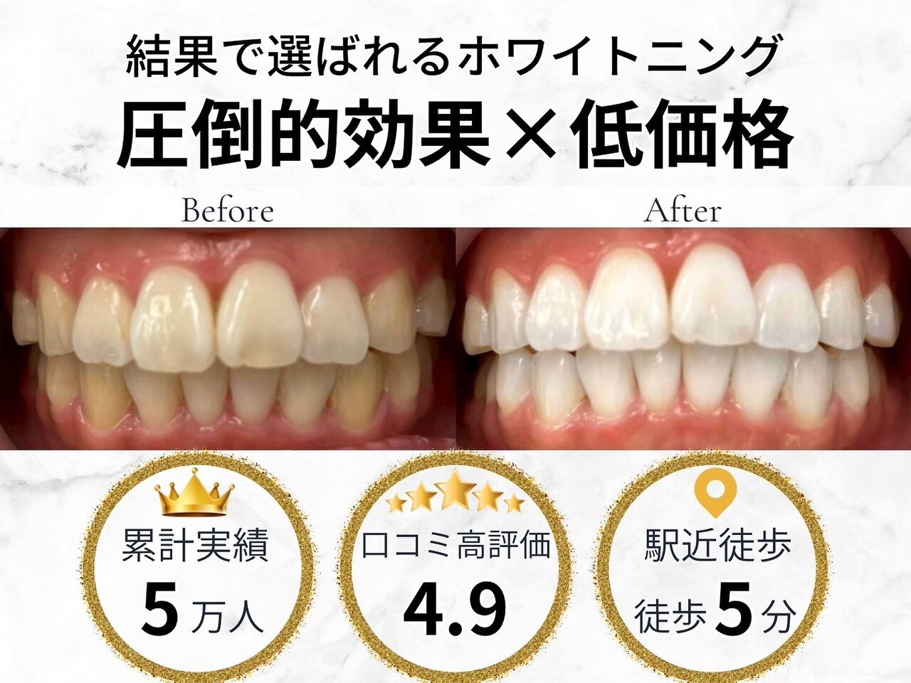 LBSホワイトニング 吉祥寺店｜ホットペッパービューティー