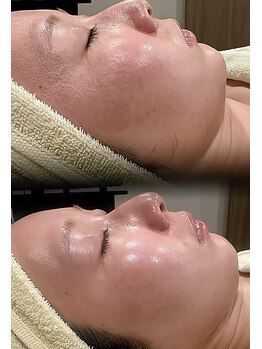 リン 大江(RIN)の写真/【しわ・くすみ・乾燥】年齢を重ねた肌に栄養を。本当に今のケアで5年後の肌は綺麗になりますか？