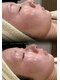 リン 大江(RIN)の写真/【しわ・くすみ・乾燥】年齢を重ねた肌に栄養を。本当に今のケアで5年後の肌は綺麗になりますか？