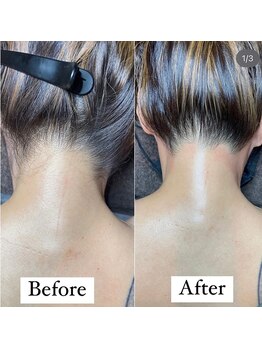 ダウニー(Downy)/30代/女性/ホステス