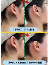 ディスイズミー シュガーリング(This is me Sugaring)/【シュガー】顔の印象が変わる