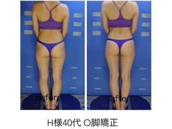 エステージ(estage)/