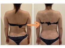 TMサロン 赤坂/7回目で激変！