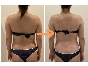 TMサロン 赤坂/7回目で激変！