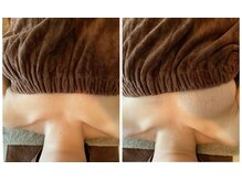 スマイルクルー(SmileClue)の雰囲気（1回の変化です！即効性のある施術で短時間で効果を感じられます）