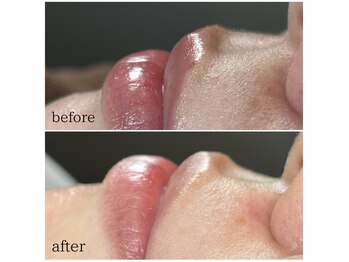 シャルム 広島店(CHARME)/フェイスwax♪