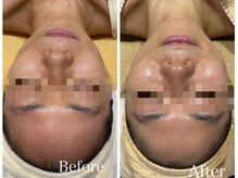 ユウ 尾張旭店(U)/エンビロンフェイシャルケア