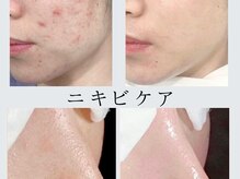 エイナミビューティサロンの雰囲気（光フェイシャル/顔脱毛/肌質改善/ニキビケア/シミくすみ改善）