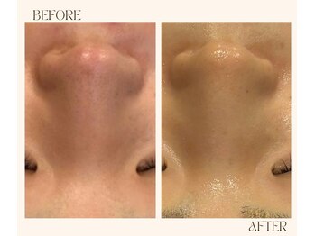 レヴ 都城店(rev)/ツヤ肌!