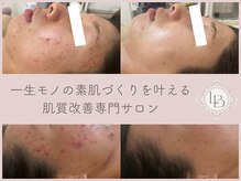 ルルボーテ(Loulou Beaute)