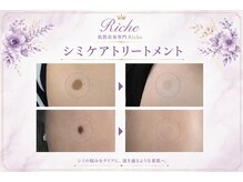 肌質改善専門Riche シミ・毛穴・たるみ【9月10日 NEWOPEN(予定)】