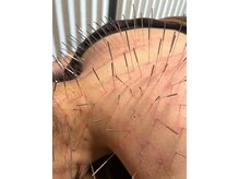 ボンド浦和鍼灸院整体院