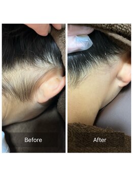 サロンインプルーヴ(Salon improve)/うなじ【before/after】