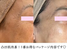 プリュボーテ(Pul Beaute)の雰囲気（エイジングケアにも効果的な凸凹肌パッケージ！リジュラン使用）