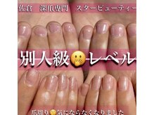 スターネイル(Starnail)/深爪さん人生変わるほど綺麗に