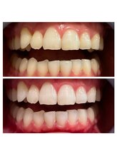 ルフレ(Reflet)/人から褒められる白さに◎