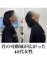 ネクスト鍼灸骨盤整骨院(Next鍼灸骨盤整骨院)/ビフォーアフター