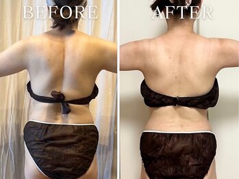 ヨサパーク ニコナ 三軒茶屋南口(YOSA PARK nicona)/短期集中！座るだけ♪