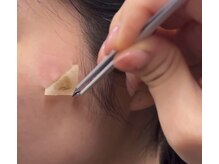 ビューティーライフ(beauty life)/韓国最新シミケア上陸