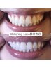 【当店人気No.1★】セルフホワイトニング×最新LED技術 ¥6500→¥3500