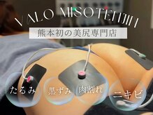 ヴァロ 熊本味噌天神(Valo)