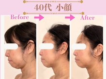 アファン 鶴見店(Afun)の雰囲気(40代からのたるみ・二重あご・ほうれい線改善に◎キュッと小顔へ)