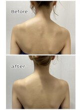 エンチャント(ENCHANT)/肩の左右差気になりますよね？