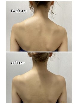 エンチャント(ENCHANT)/肩の左右差気になりますよね？