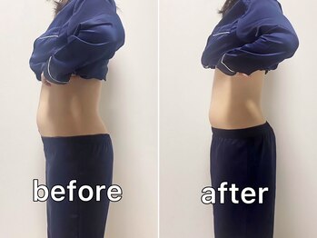 サンク(Cinq)/【腸もみ+骨格矯正】ダイエット