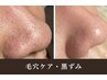 【毛穴悩み・肌質改善】毛穴洗浄+ハーブピーリング60分￥9,900