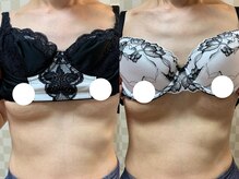 ハレオラ(HaleOla)/お客様の変化☆バストケア