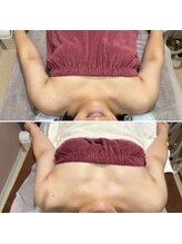 アンベリール(Embellir)/ボンボンバスト