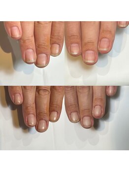 キュア(Cure.)/男性のお客様の割れやすい爪