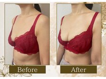 マリン(MARINE)/50代Before→After