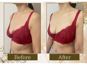 マリン(MARINE)/50代Before→After