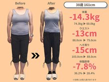 ニドム/38歳　-14kg産後痩身ダイエット1