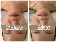 小顔/フェイシャル/肩こり/ヘッドスパ/首コリ/眼精疲労/たるみ