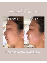 エン(enn.)/リリースカッターフェイシャル