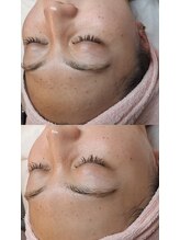 バリューネクスト 青葉台/◆マンデルホワイトピール◆