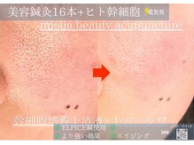 ミエリア美容鍼灸院(mielia美容鍼灸院)/幹細胞美容鍼灸〈幹細胞facia〉