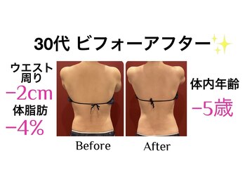 ルミーナ 高崎本店(Lumina)の写真/【短期集中痩身プログラムが破格！】本気で早く痩せたい方の二の腕・ハミ肉ケアに☆