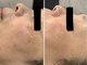 ケイ(Kei)の写真/肌の根本からケア!ハリやくすみを改善し透明感のある艶やかなお顔に♪本気で肌質改善をしたい方も◎